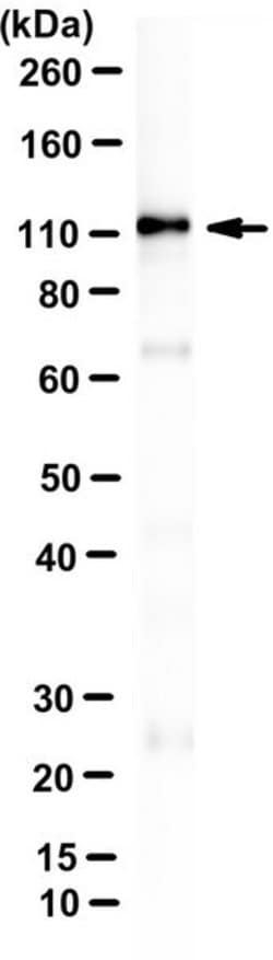 TrpC5 Mouse anti-Human, Mouse, Clone: N67/15, MilliporeSigma:Antibodies:Primary